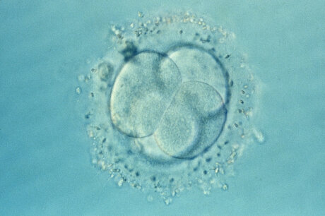 ©  Inserm/Lassalle, Bruno